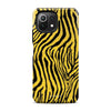 Kenzo Yellow - Xiaomi Mi 11 Lite