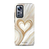 Lueur Gold - Xiaomi 12 / 12x